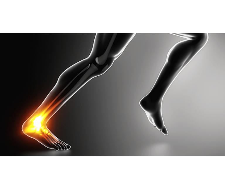 What You Need To Know About Heel Pain