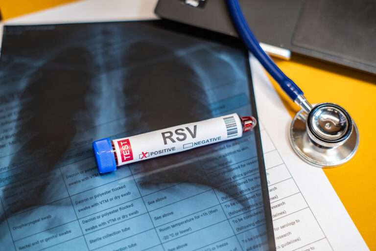 RSV Can Impact Adults Too. Here’s What to Know