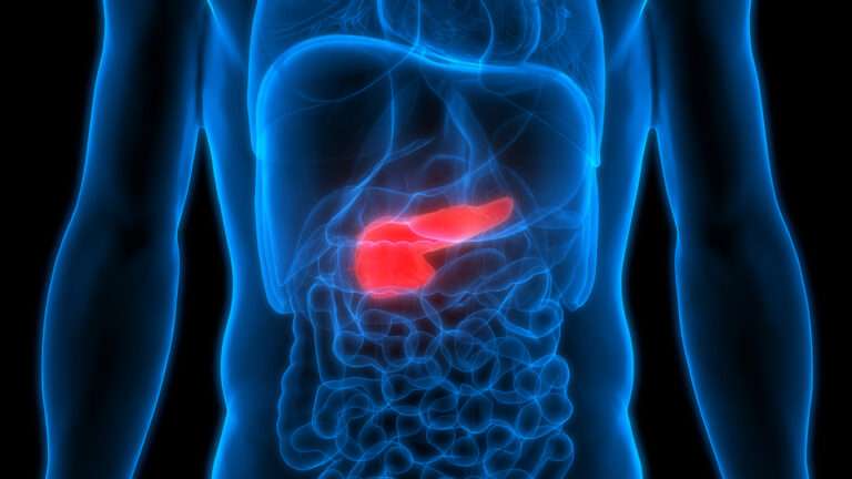 Pancreatic Cancer: How it Affects the Body, Statistics and More