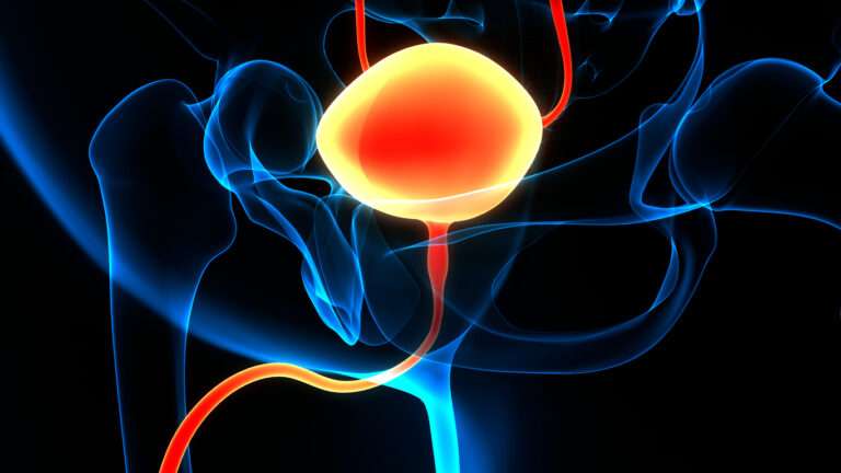 What to Know After a Bladder Cancer Diagnosis