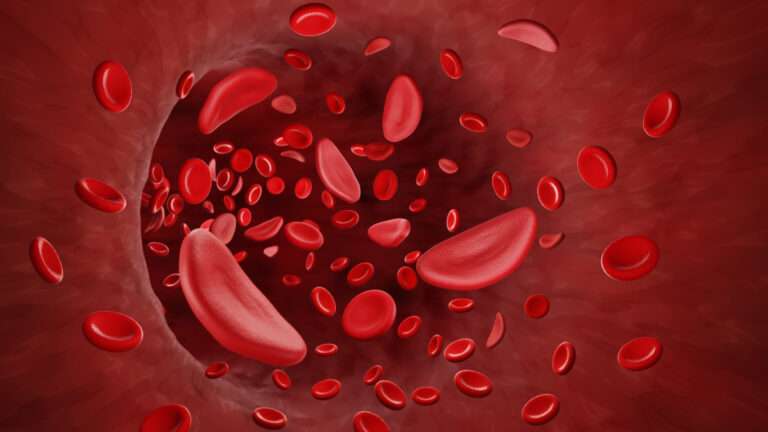 Things Most People Don’t Know About Sickle Cell